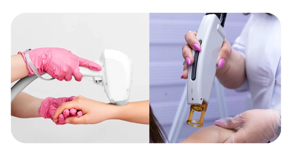 دستگاه رولی یا شاتی