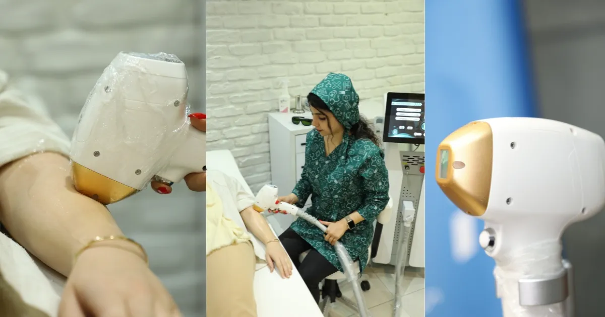 دستگاه لیزر رولی