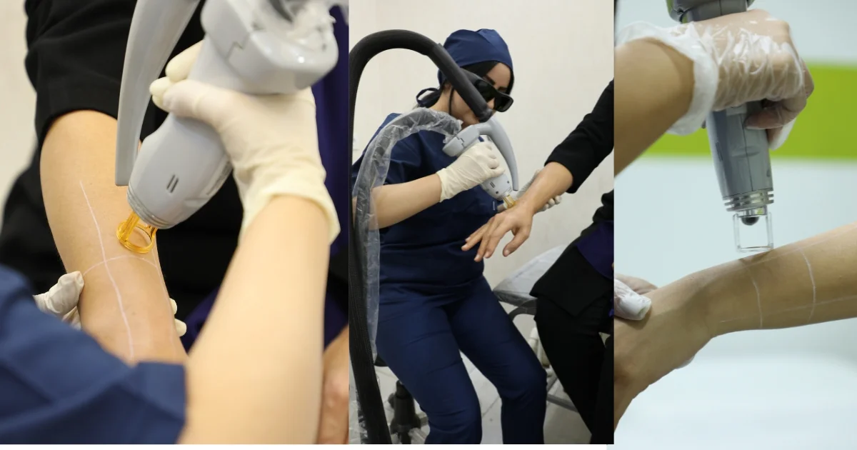 دستگاه لیزر شاتی