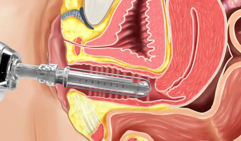 درمان ضایعات پوستی