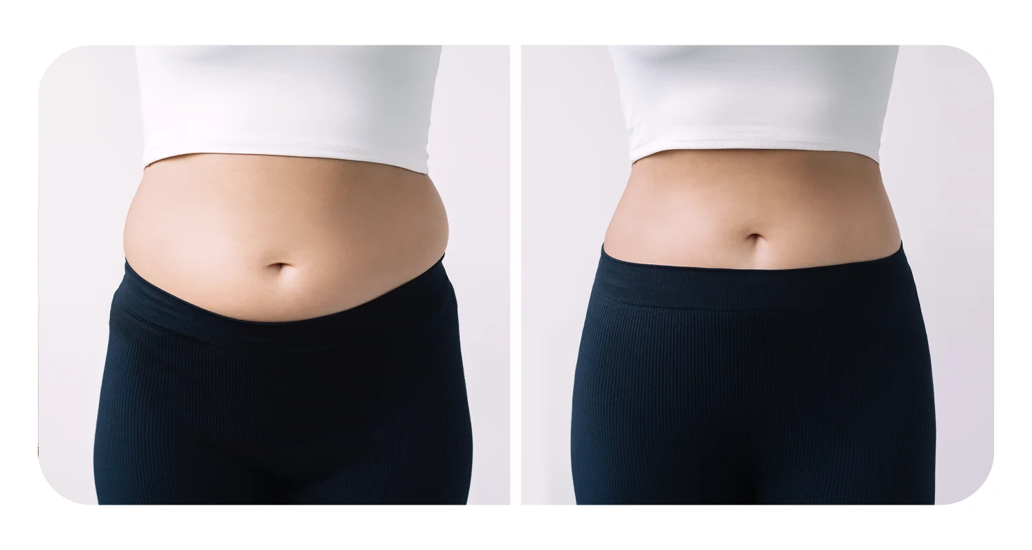 سریع ترین روش لاغری شکم و پهلو