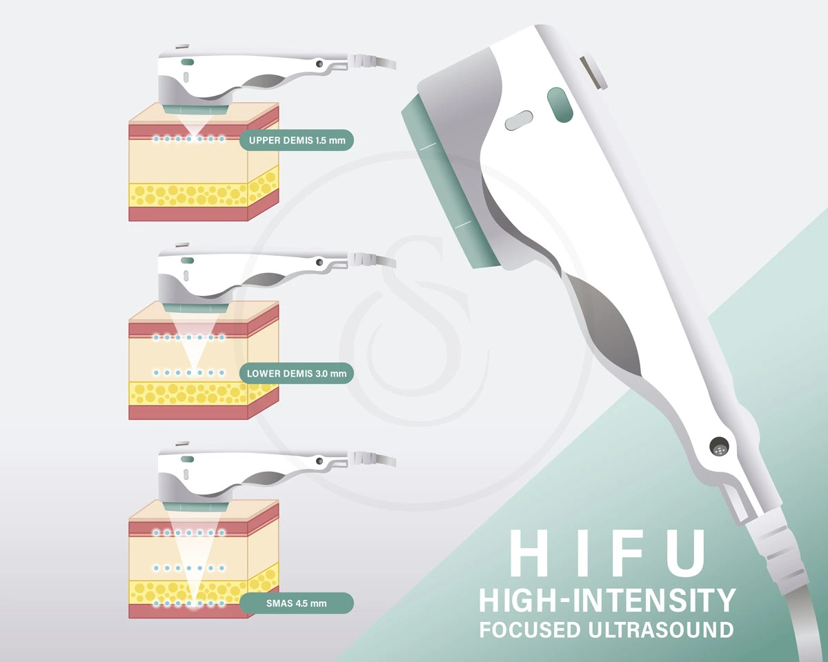 هایفوتراپی چیست