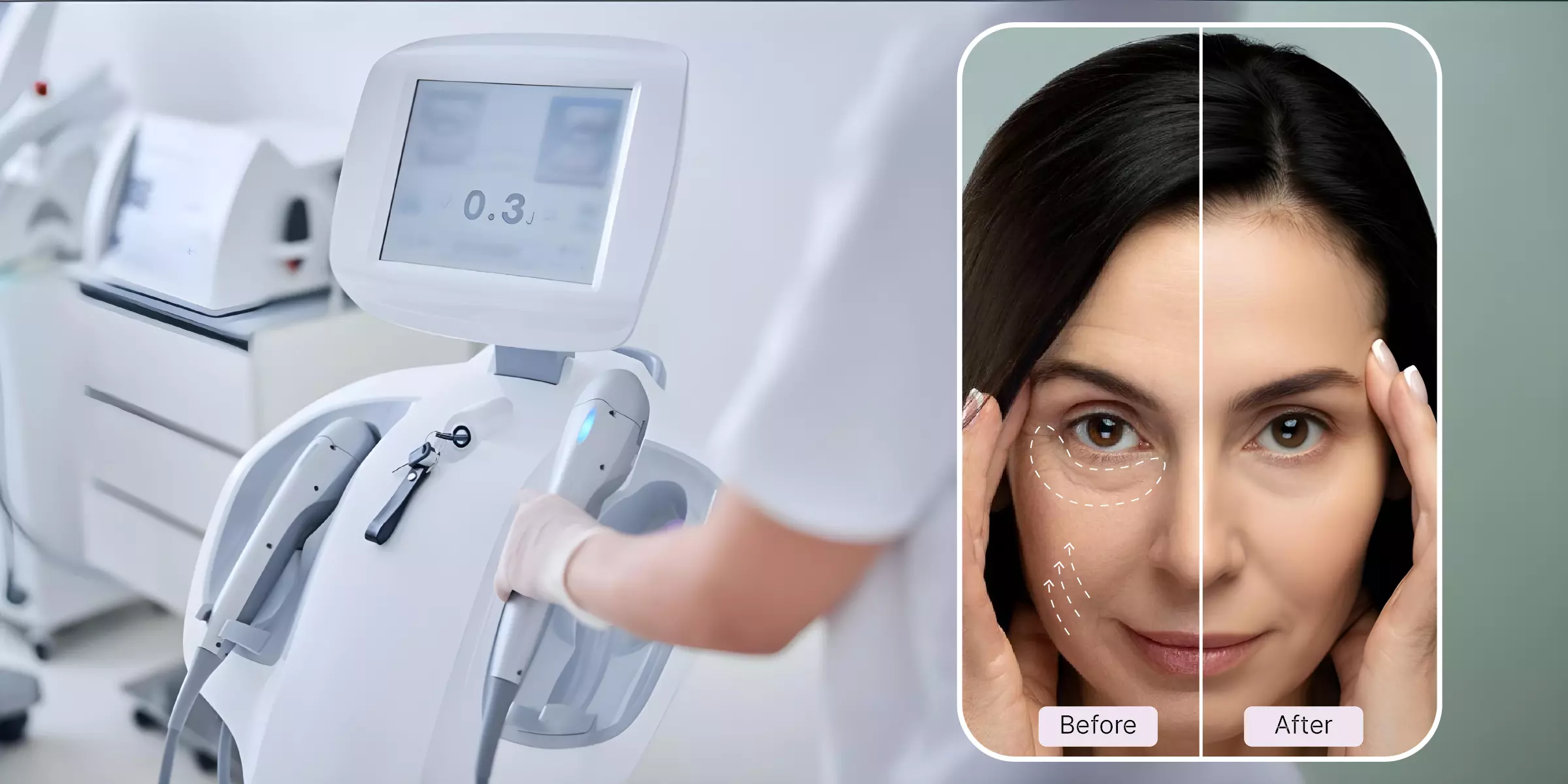 هایفوتراپی چیست